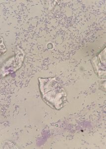 Pseudomonas in oorsmeer uitstrijkje